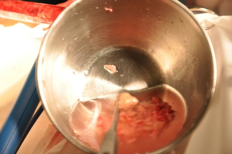 Silicon hóa 'đá' sau 30 năm bơm vào mũi ảnh 2