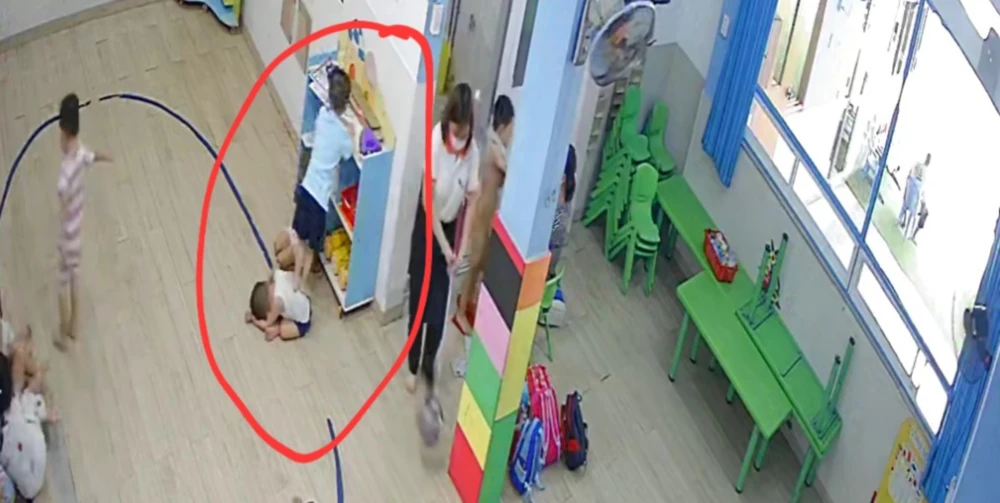 Bé bị bạn dẫm lên người. Ảnh: PHCC