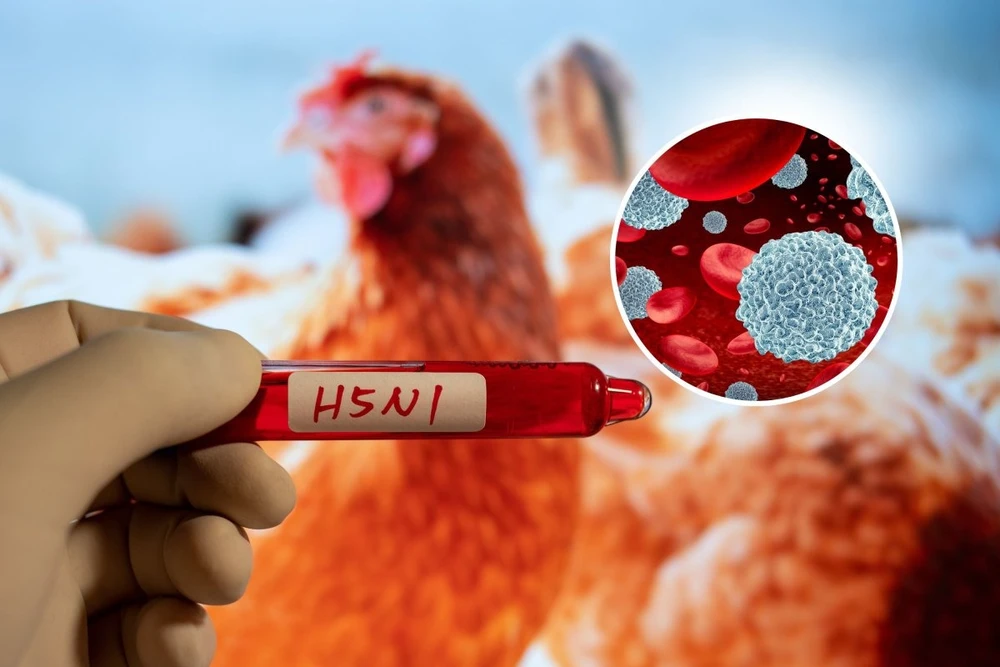 Chuyên gia thúc giục Mỹ hành động sau ca tử vong đầu tiên do cúm gia cầm H5N1