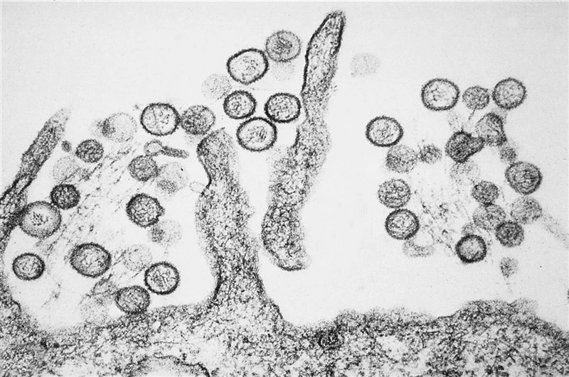 dai-loan-ghi-nhan-ca-mac-virus-hanta-thu-hai.png