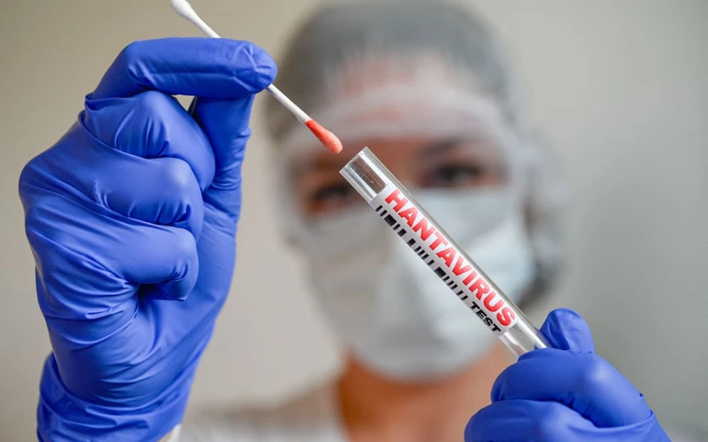 tai-sao-dich-benh-virus-hanta-khac-covid-19.png