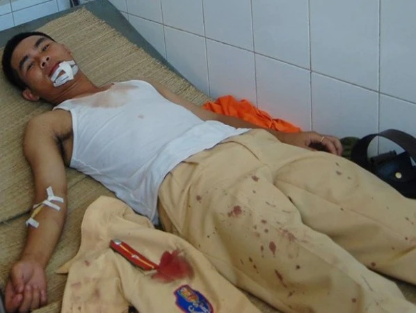 Dũng cảm cứu người, thiếu úy CSGT bị côn đồ chém ảnh 1