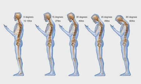 Sử dụng smartphone nhiều có thể ảnh hưởng xấu đến cột sống ảnh 1 Sử dụng smartphone nhiều có thể ảnh hưởng xấu đến cột sống