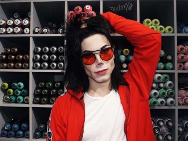 15 tuổi trải qua 11 ca phẫu thuật để giống Michael Jackson