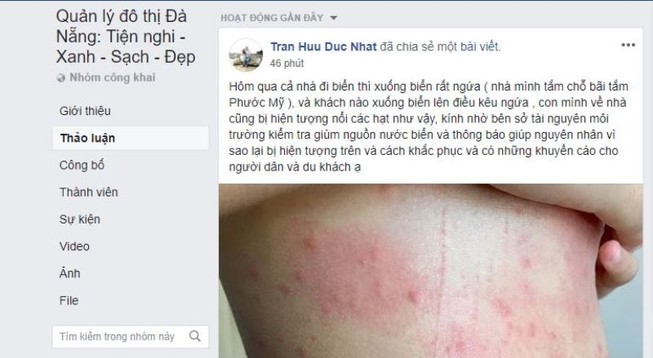 Dân Đà Nẵng lo lắng khi cứ tắm biển là ngứa