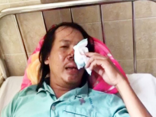 'Hiệp sĩ' bị bắn khi truy đuổi nhóm nghi can trộm chó