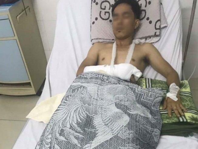 Nghi mâu thuẫn hát loa kẹo kéo, truy sát bằng súng, mã tấu