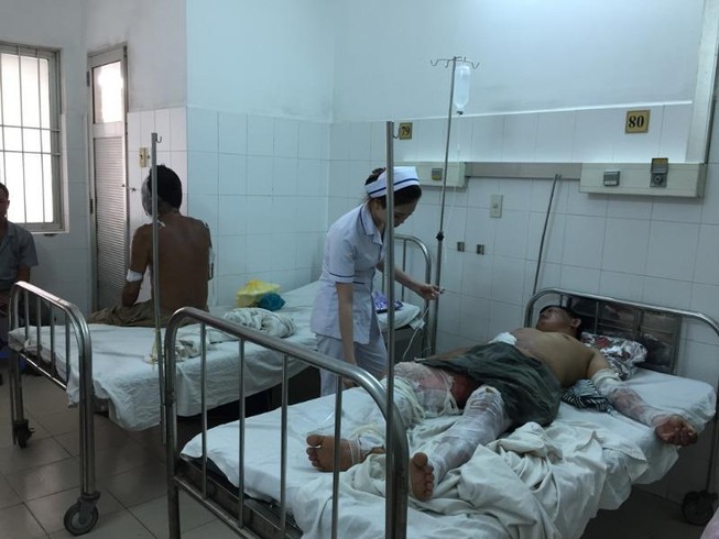 Cháy bếp cồn ở tiệc cưới, 8 người bị bỏng nặng