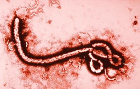 WHO khuyến cáo người khỏi Ebola kiêng sex trong 3 tháng