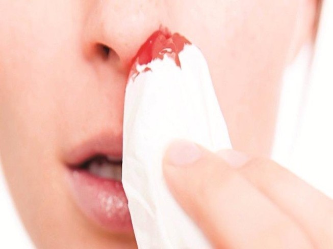 Tự nhiên chảy máu cam, dấu hiệu của nhiều bệnh về mũi