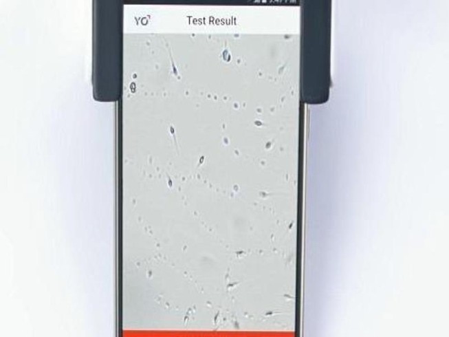 Tự kiểm tra chất lượng tinh trùng bằng smartphone
