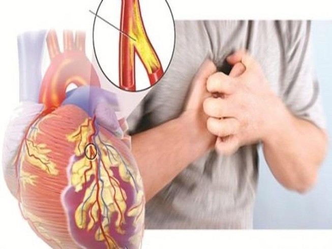 6 dấu hiệu cảnh báo sớm bệnh tim mạch
