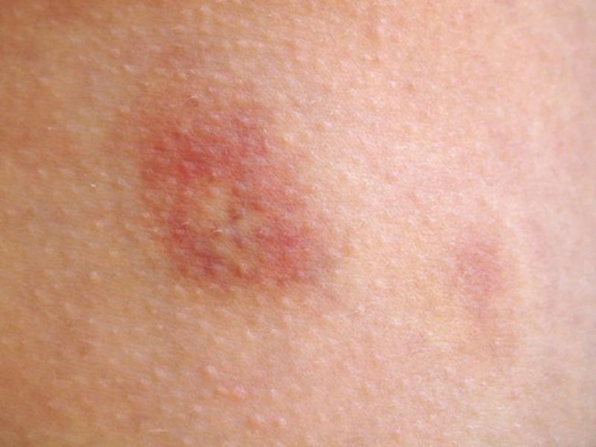 10 biểu hiện lạ trên da có thể là dấu hiệu bệnh nghiêm trọng