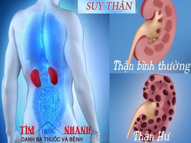 Dấu hiệu nhận biết suy thận