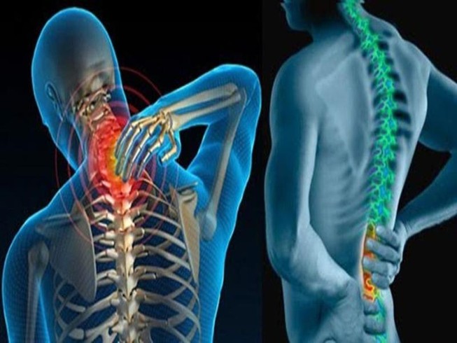 Hướng dẫn tư thế đúng cho người bị bệnh cột sống