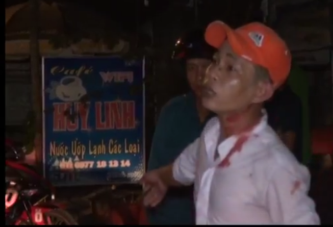 Hỗn chiến ở nhà nghỉ, 3 người nhập viện