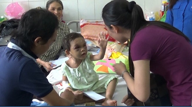 Bé bốn tuổi bị mẹ và tình nhân hành hạ đã ra viện