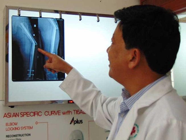 Đinh đóng vô người thì nhớ lấy ra