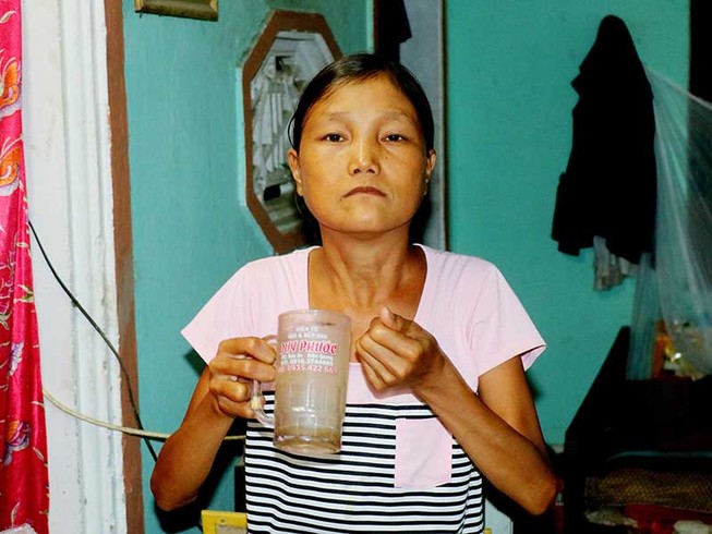 Chuyện lạ: Người ăn 5 lon gạo/ngày, chỉ nặng 26 ký