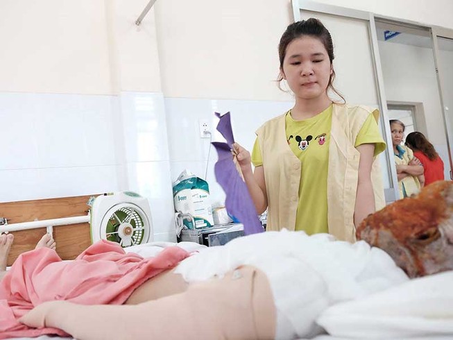 Cô gái 17 tuổi bị hủy hoại khuôn mặt vì acid