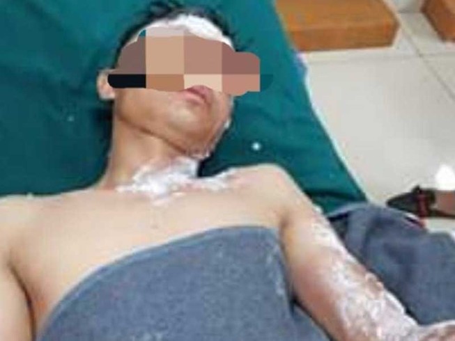 Cấp cứu ngộ độc rượu, pháo tăng chóng mặt