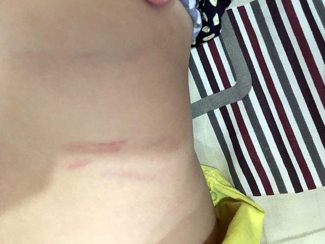 Con bị đánh, cha đề nghị trường bồi thường… 100 triệu đồng