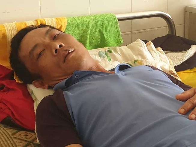 Chủ đầu tư dự án điện mặt trời bắt trói dân