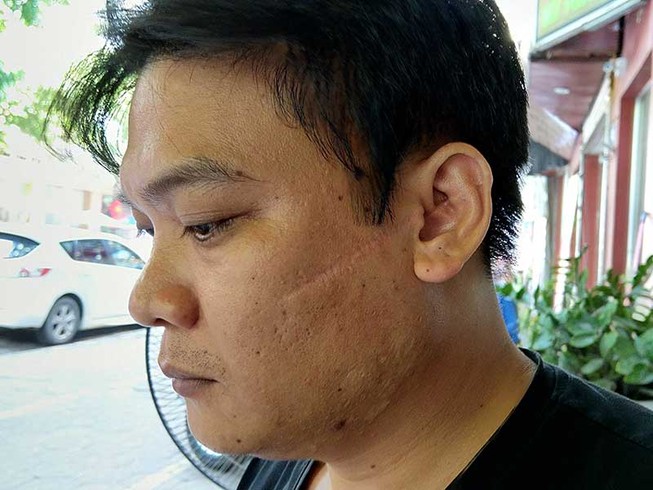 Nghi án lọt người, lọt tội ở Hải Phòng