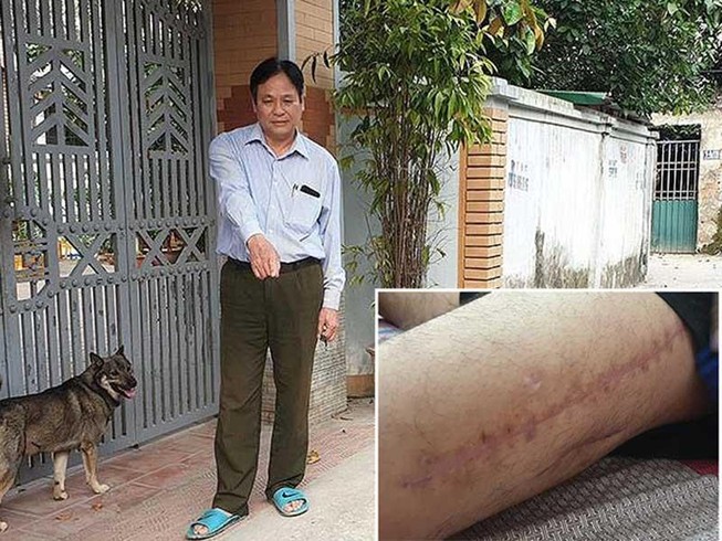 Làm rõ vụ bị cảnh sát 113 bắn vào đùi