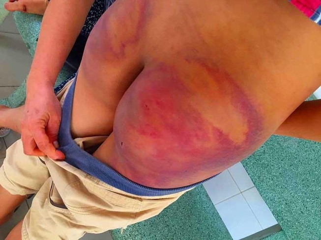 ‘Nhà tu hành’ đánh dã man trẻ tu tập
