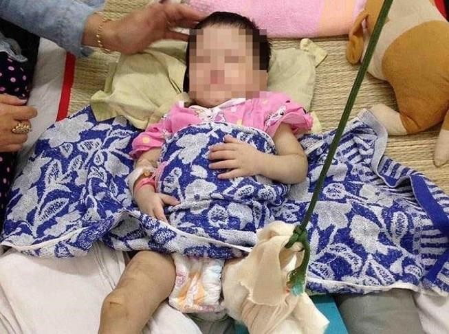 Bé gái bị mẹ nuôi đánh gãy chân: Nụ cười bé thơ và nỗi xót xa
