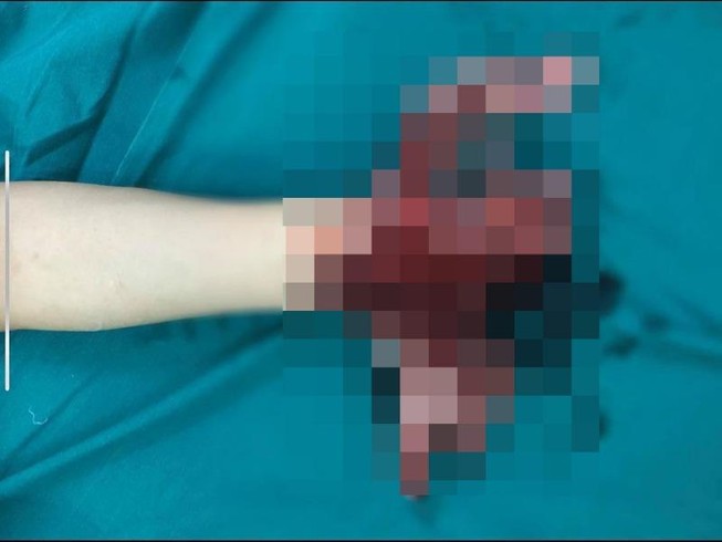 Ảnh: Bệnh viện cung cấp
