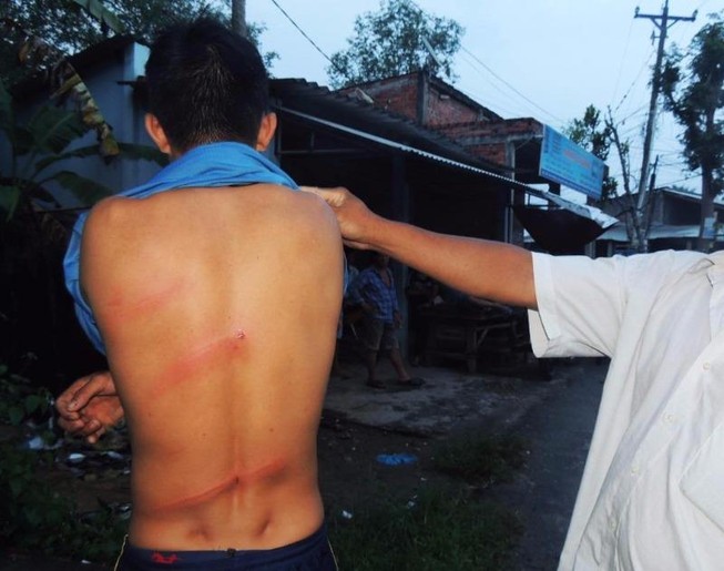 1 thanh niên nghi bị chủ nợ cho người hành hung