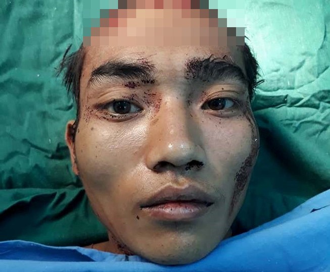 Ảo giác, chồng giết chết con, vợ bị thương