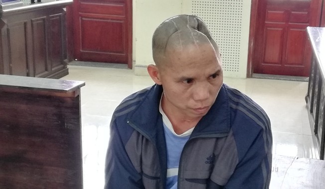 Bị mất nửa hộp sọ vẫn lãnh án về tội giết người