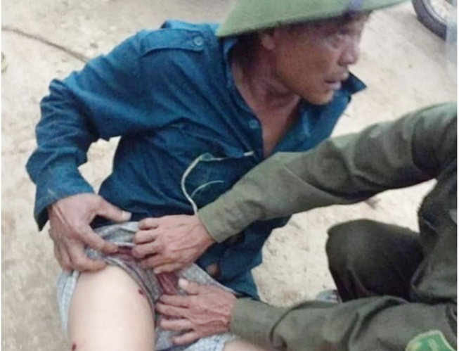 Tạm giữ hình sự kẻ đi xe hơi dùng súng bắn trưởng thôn