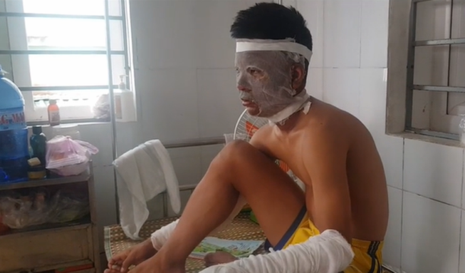 Chùm bóng bay phát nổ, 3 cầu thủ U-14 Sông Lam Nghệ An cấp cứu