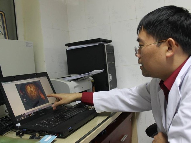 Suýt mất mạng vì ăn hồng ngâm