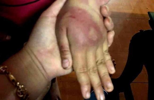 Bố đánh con gái 8 tuổi dã man rồi bỏ trốn