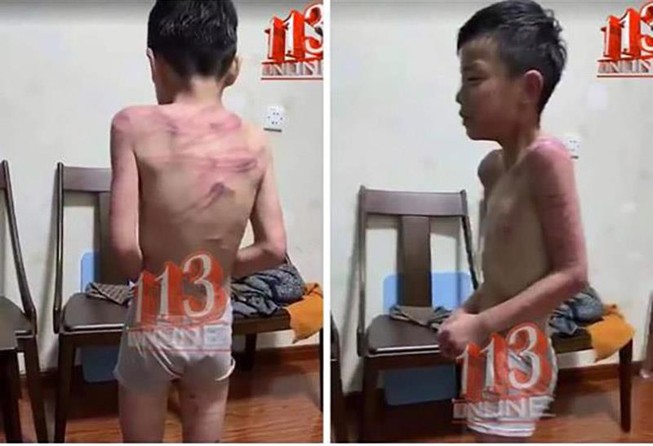 'Bé trai bị bố dượng đánh': Công an 36 xã thị trấn xác minh