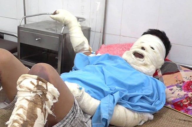 Nổ bình ga trong đám tang, 5 người nhập viện