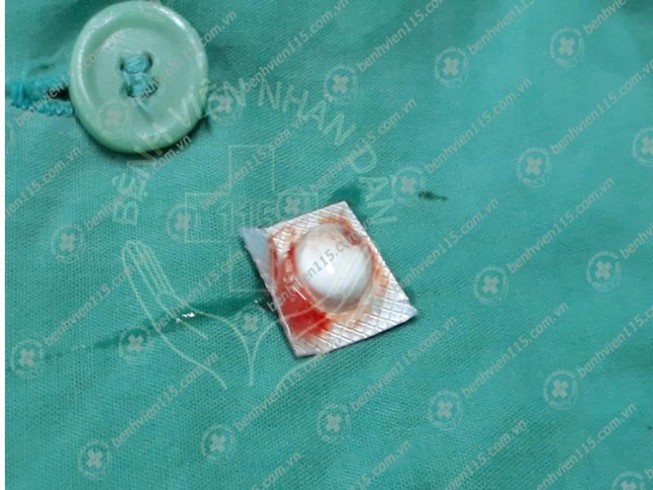 Ho ra máu vì uống nhầm viên thuốc chưa bóc vỏ