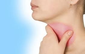 Thực phẩm nên và không nên dùng khi viêm họng
