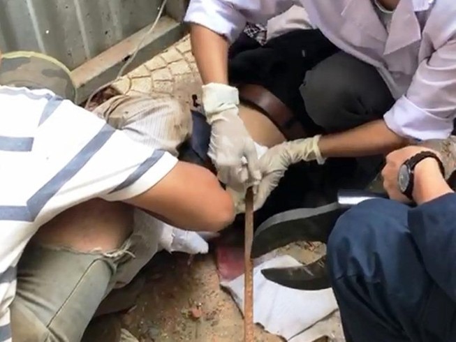 Người đàn ông bị thanh sắt rơi từ trên cao đâm xuyên bụng