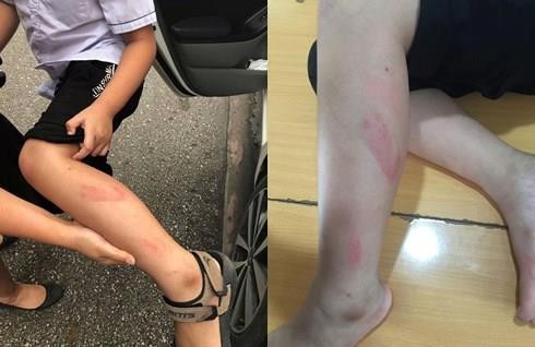 Cô giáo tát học sinh giờ kiểm tra bị đình chỉ 6 tháng