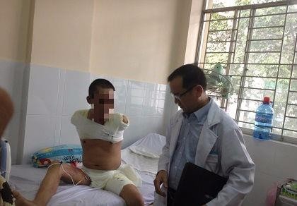 Cắt hai tay và 1 chân cứu bệnh nhân bị phỏng điện