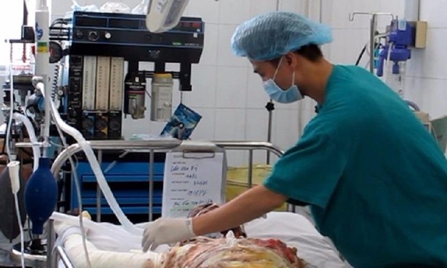 Nổ máy biến thế, kỹ sư và công nhân bỏng nặng