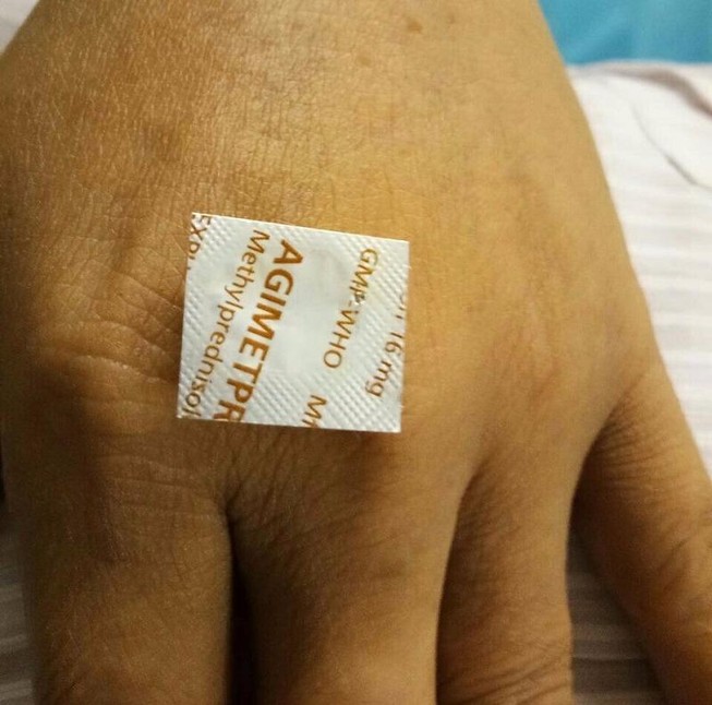 Nuốt vỏ viên thuốc sắc cạnh vào bụng 10 ngày không sao