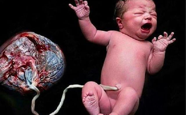 Hàng loạt bác sĩ lên án mạnh mẽ “sinh thuận tự nhiên“