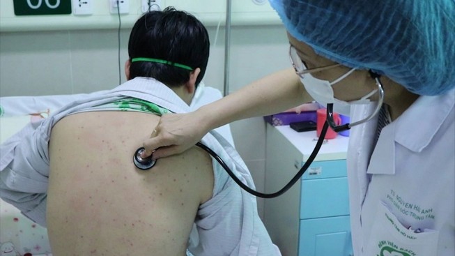 Hi hữu: Lần đầu tiên xuất hiện bệnh ho gà ở người lớn